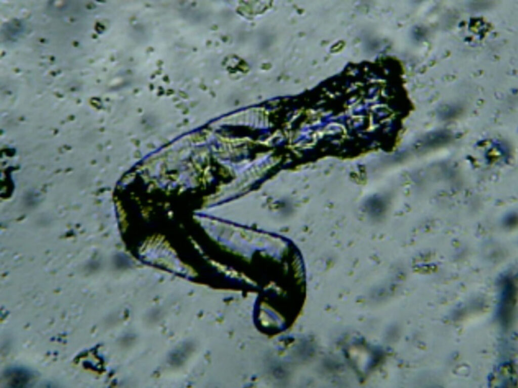 Demodex visto con microscopio