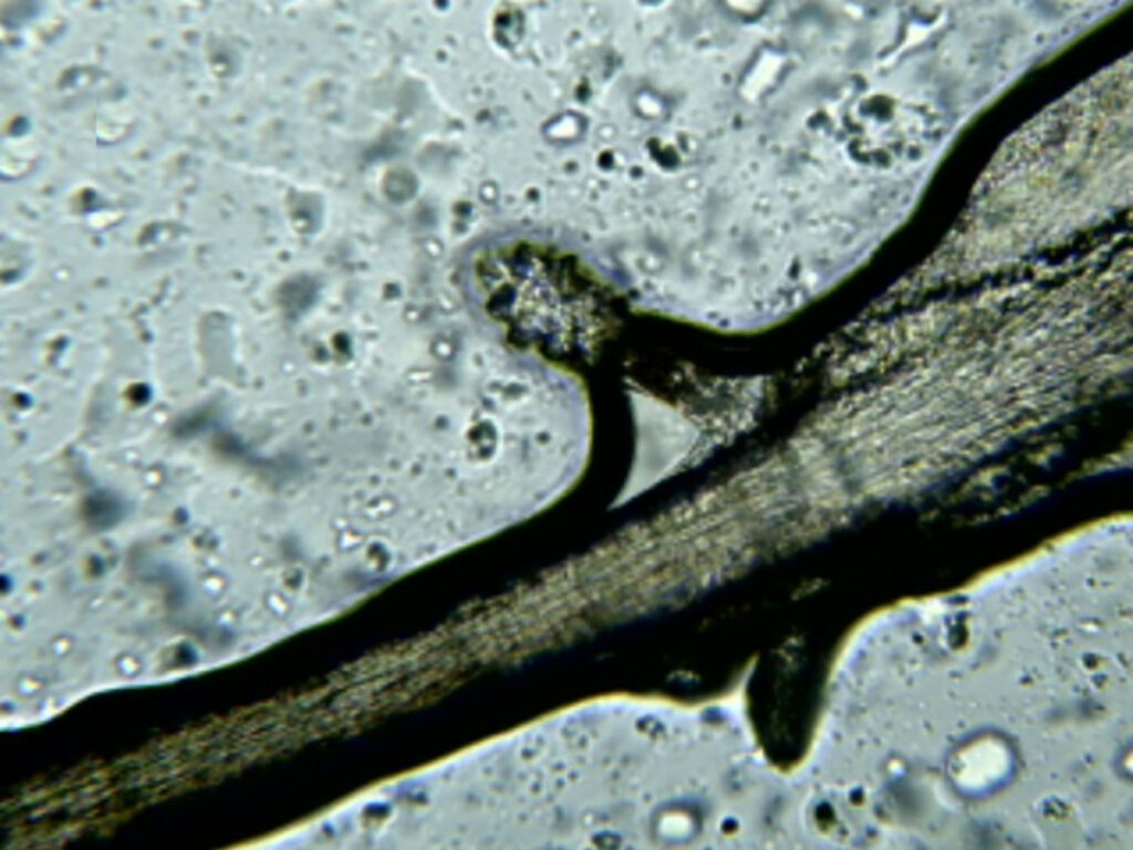 Demodex folliculorum en el folículo de una pestaña,