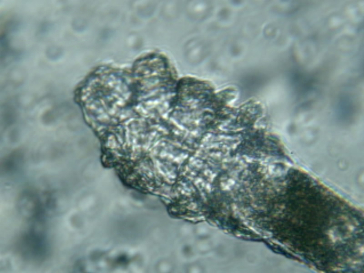 Demodex folliculorum. Visualización con microscopio de Centros Palomar, a mayor aumento.