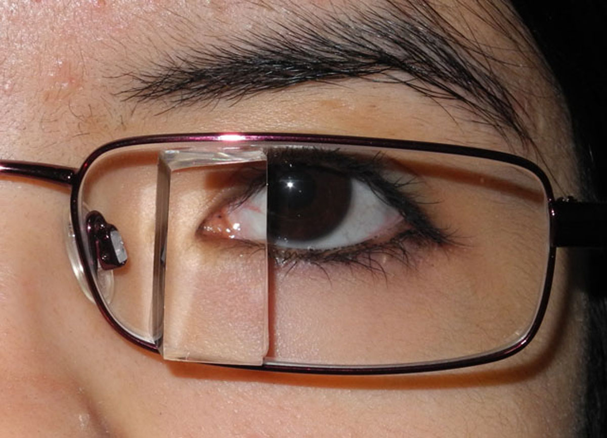 Gafas con prismas adosados de Palomar para hemianopsia