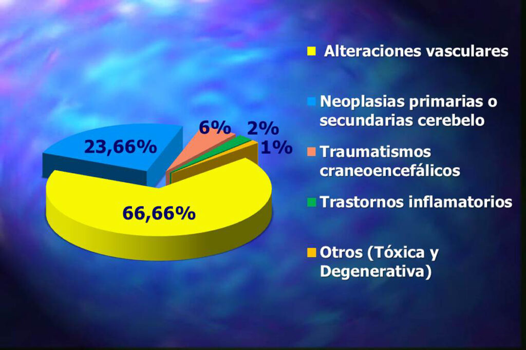 Hemianopsia, causas clasificación por el doctor Palomar