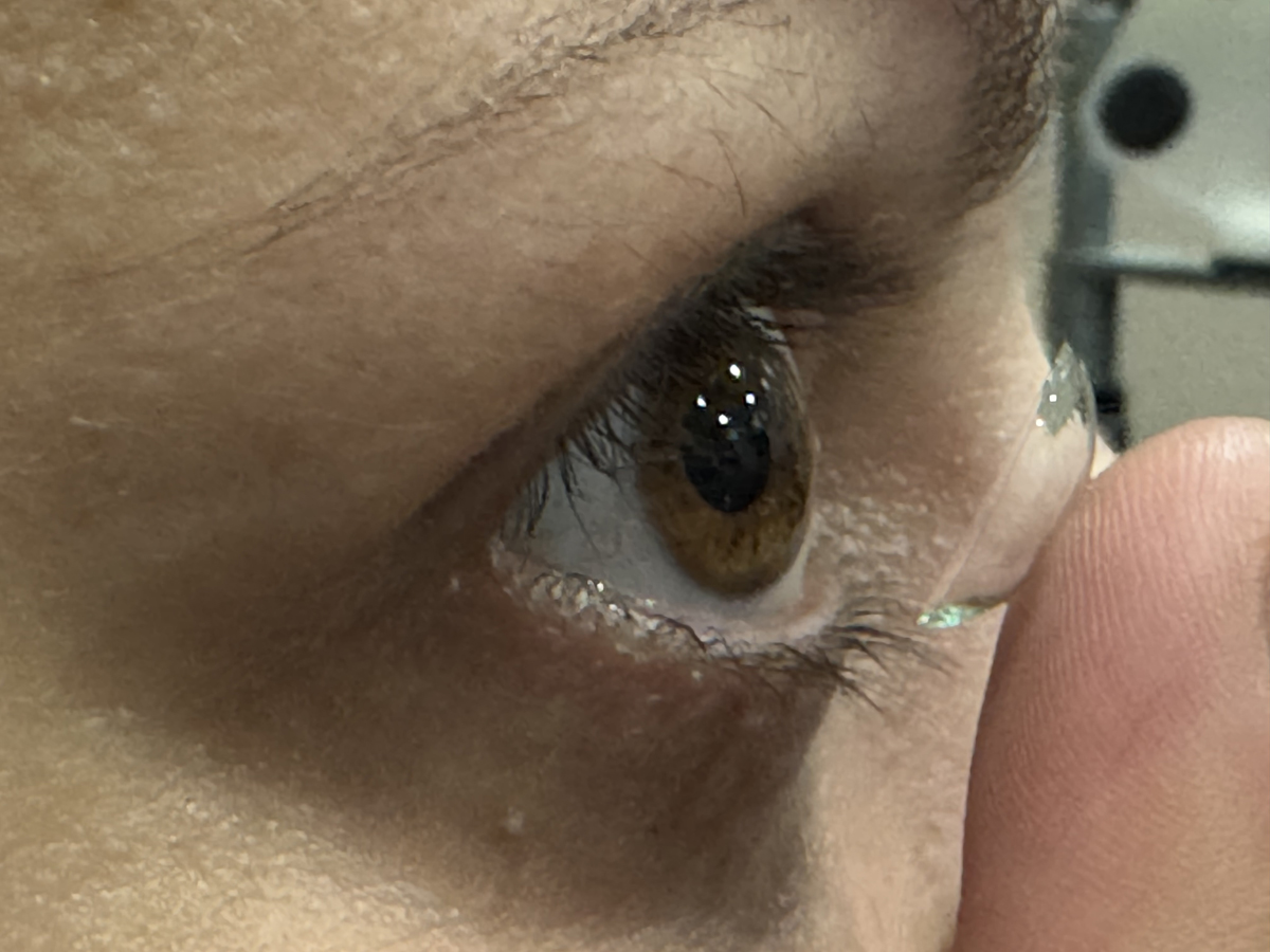 Las lentes de contacto blandas son aquellas que dentro de la composición del material, tienen agua, es un material hidratado