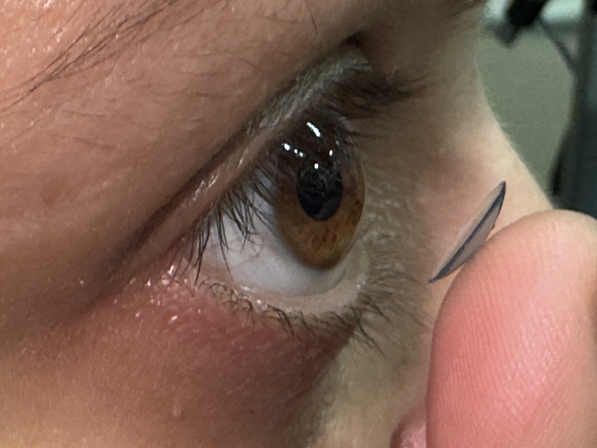 Lentes de contacto semirrigidas o rigidas